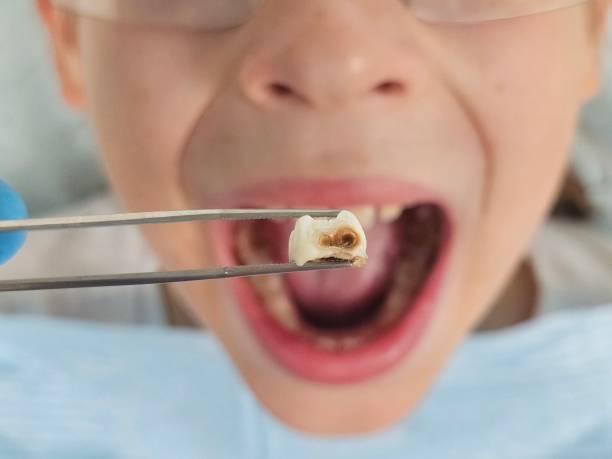 Best Urgent Tooth Repair  in Florence, KY