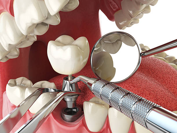 Best Knocked-Out Tooth Emergency  in Florence, KY